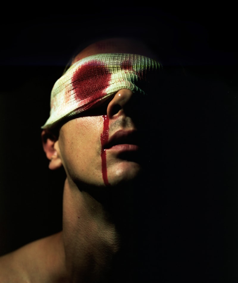 Charles Bonnet Syndrome: Visions Beyond Blindness