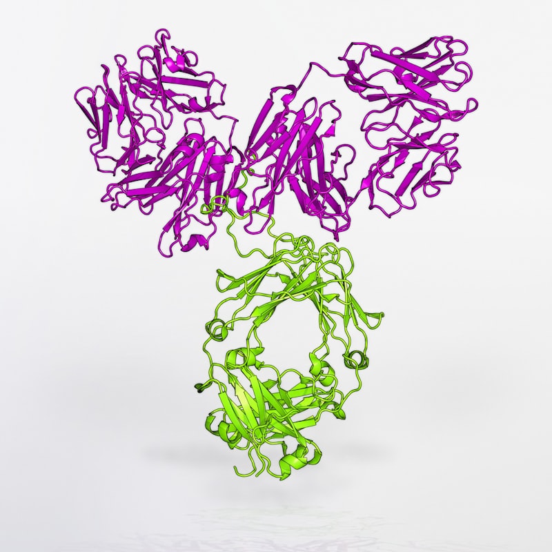 Hyperacusis