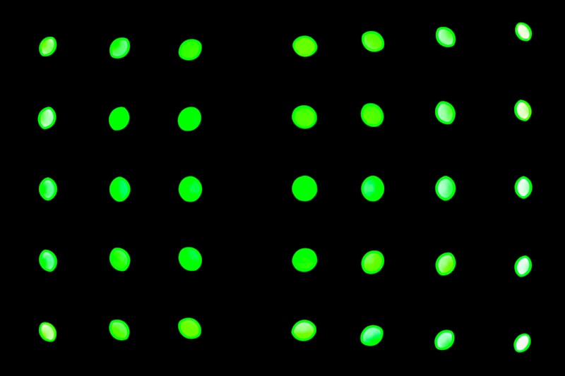 Phosphenes: Seeing Light Without a Visual Stimulus