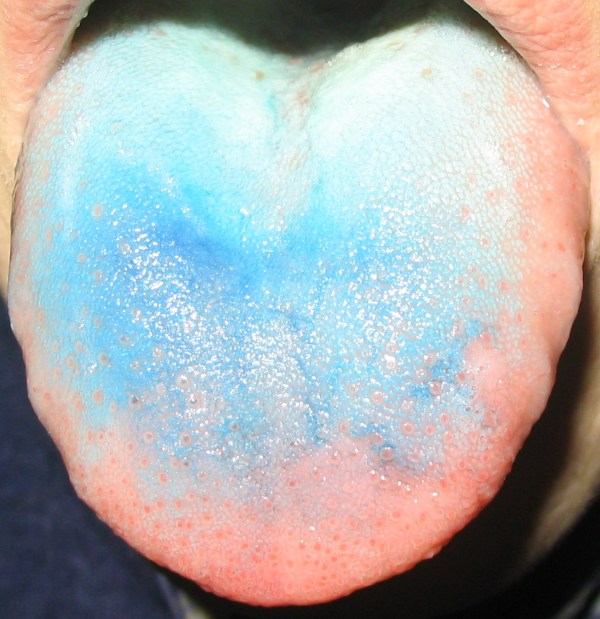 Blue tongue Psynso